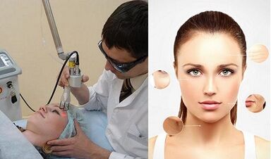 كيف تتم عملية تجديد الجلد بالليزر؟